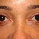 30 days after (March 14th)